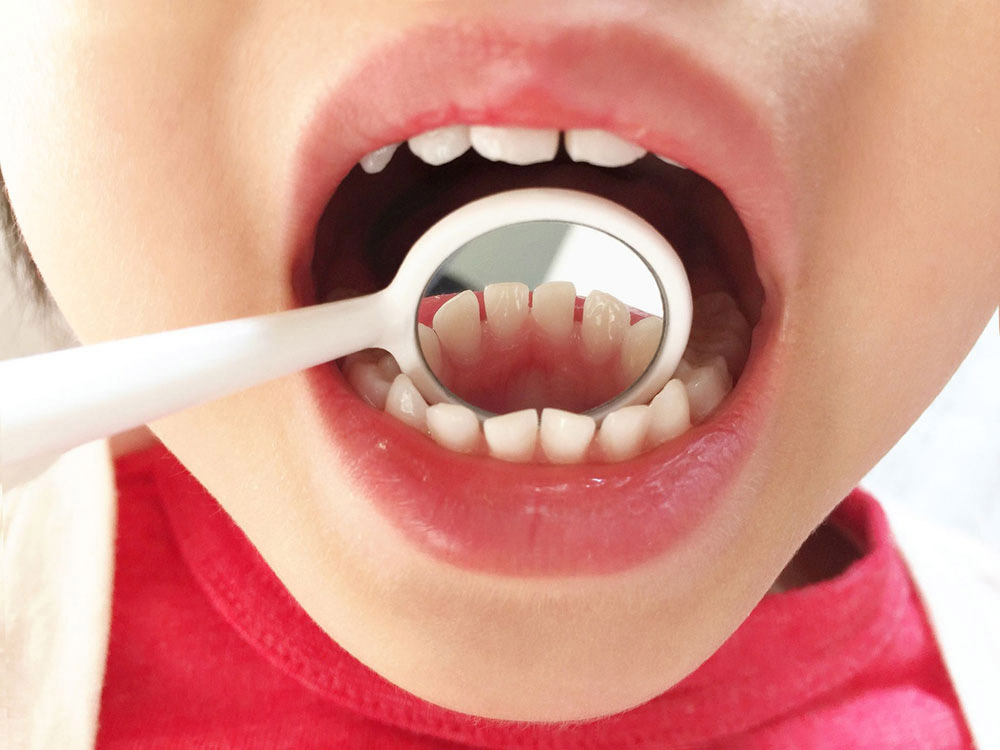 子どもの予防の大切さ